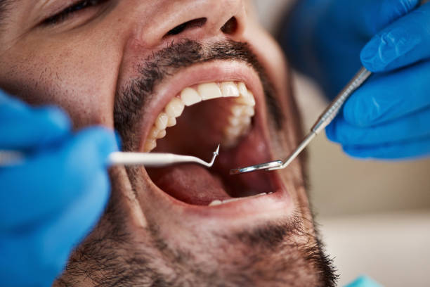 Best Mobile Emergency Dentist in Crane, MO